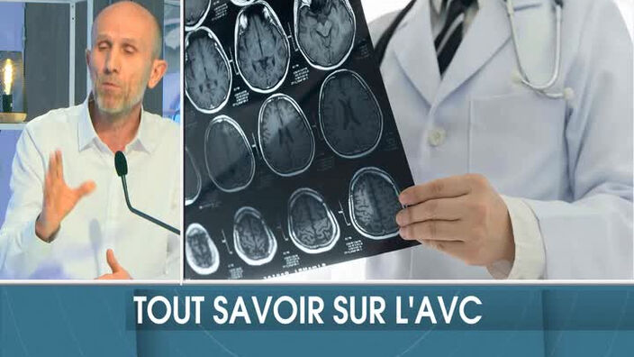 Tout savoir sur l'AVC