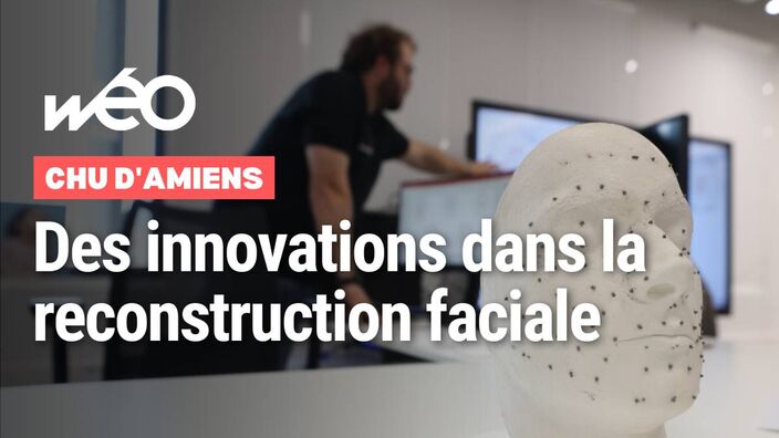Institut Faire Faces : 3 projets innovants pour la reconstruction faciale