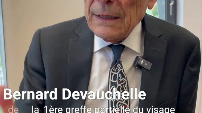 20 ans après la première greffe du visage